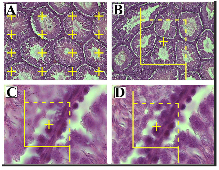 Extremely Low Frequency-Electromagnetic Fields (ELF-EMF) Can Decrease Spermatocyte Count and Motility and Change Testicular Tissue.