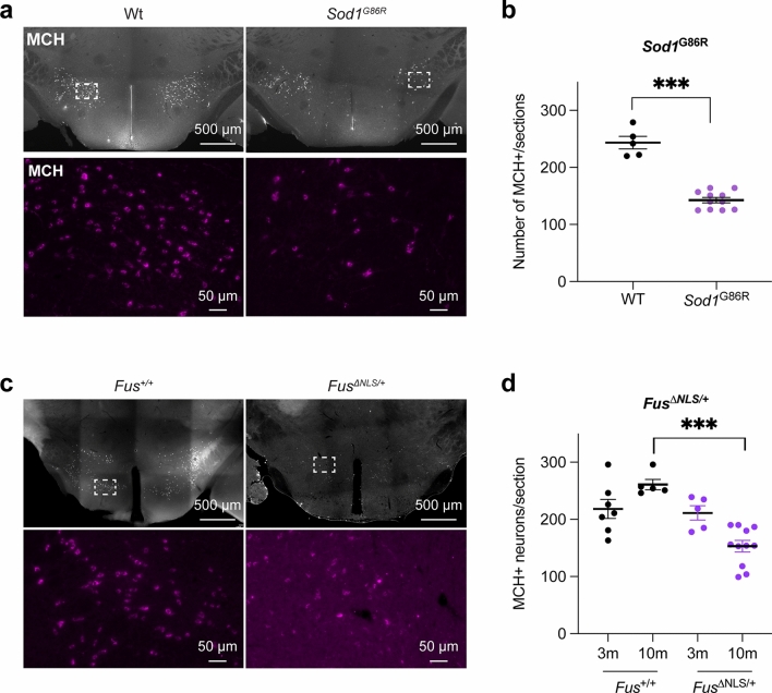 Loss of hypothalamic MCH decreases food intake in amyotrophic lateral sclerosis