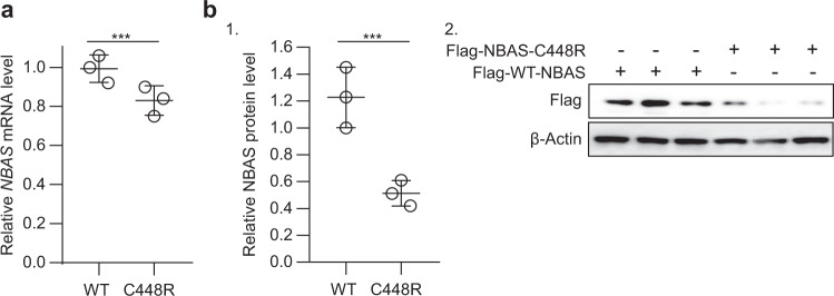 A novel variant in NBAS identified from an infant with fever-triggered recurrent acute liver failure disrupts the function of the gene.