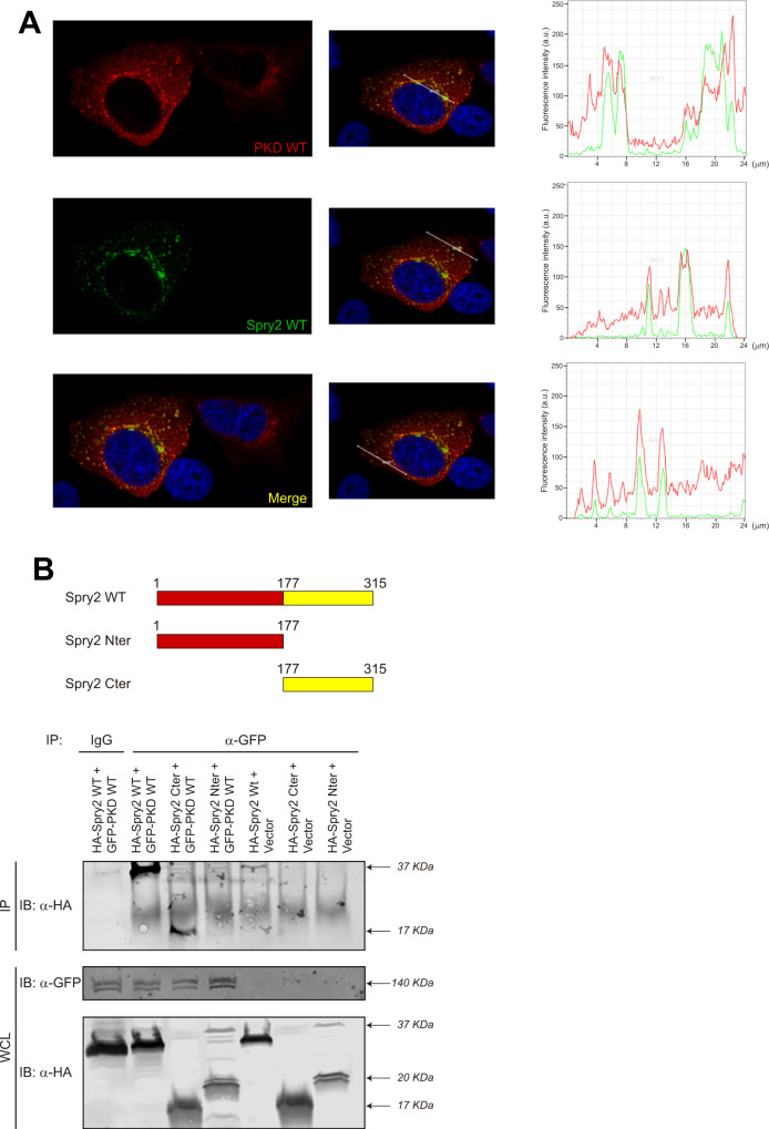 PKD phosphorylation and COP9/Signalosome modulate intracellular Spry2 protein stability.