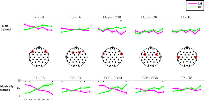 Cortical representation of musical pitch in event-related potentials.