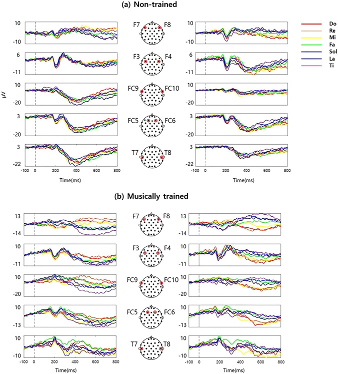 Cortical representation of musical pitch in event-related potentials.