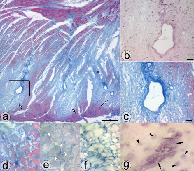 Optimization Techniques of Single-Detergent Based Protocols for Heart Tissue Decellularization.