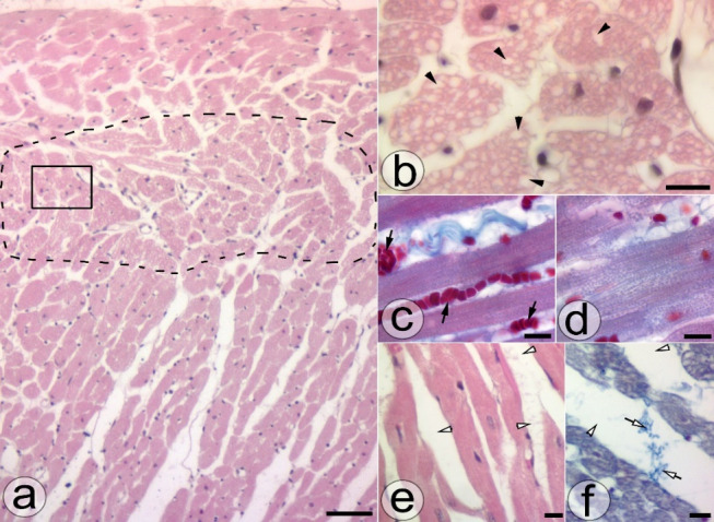 Optimization Techniques of Single-Detergent Based Protocols for Heart Tissue Decellularization.