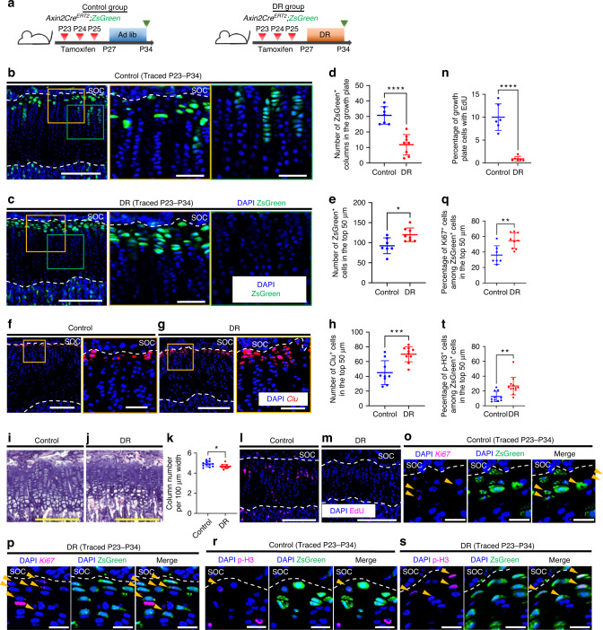 Nutrient-regulated dynamics of chondroprogenitors in the postnatal murine growth plate.