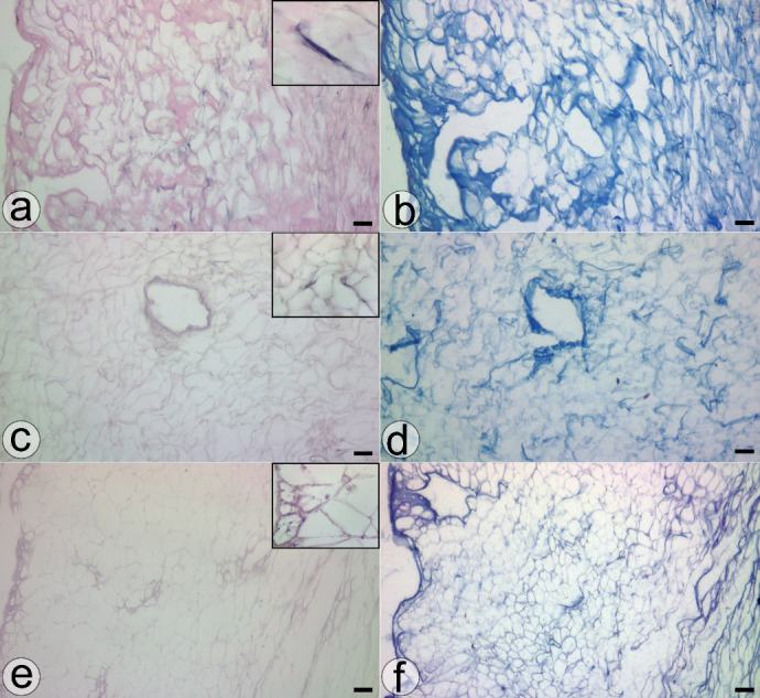 Optimization Techniques of Single-Detergent Based Protocols for Heart Tissue Decellularization.