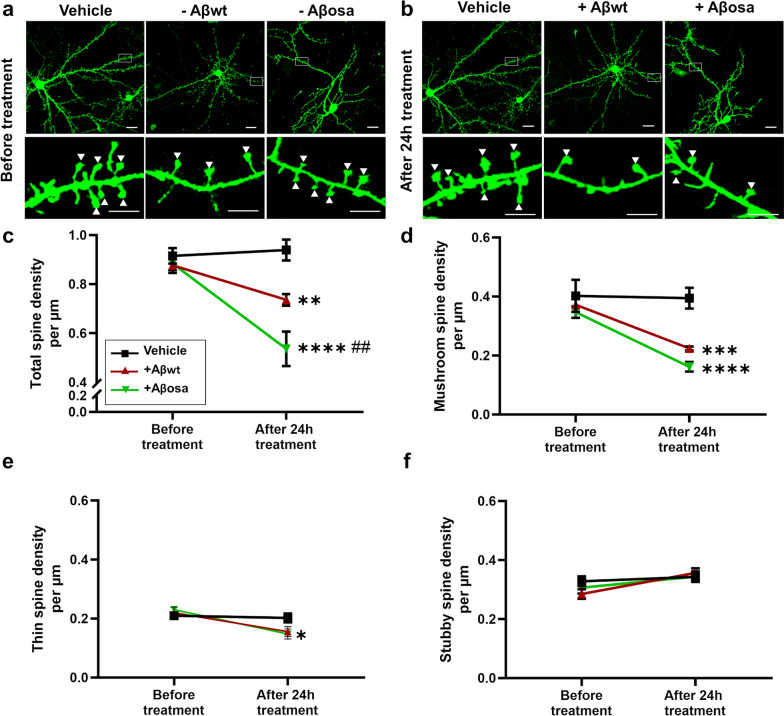 Long term worsening of amyloid pathology, cerebral function, and cognition after a single inoculation of beta-amyloid seeds with Osaka mutation.