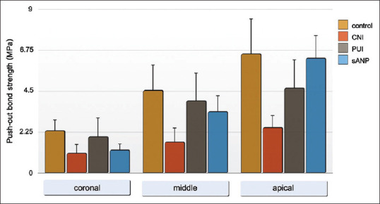 The Bond Strength of Root Canal Filling after Calcium Hydroxide Removal with a Simple Apical Negative Pressure Kit in Oval-Shaped Root Canal.