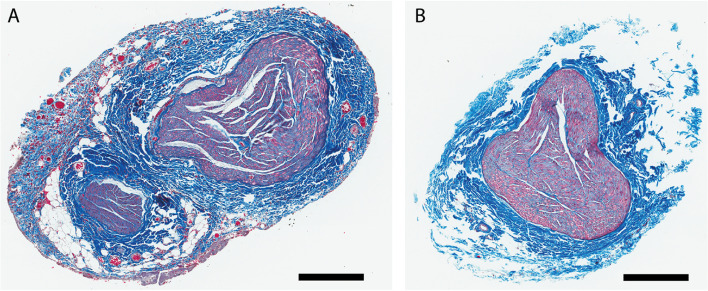 Vagus nerve stimulation in the non-human primate: implantation methodology, characterization of nerve anatomy, target engagement and experimental applications.