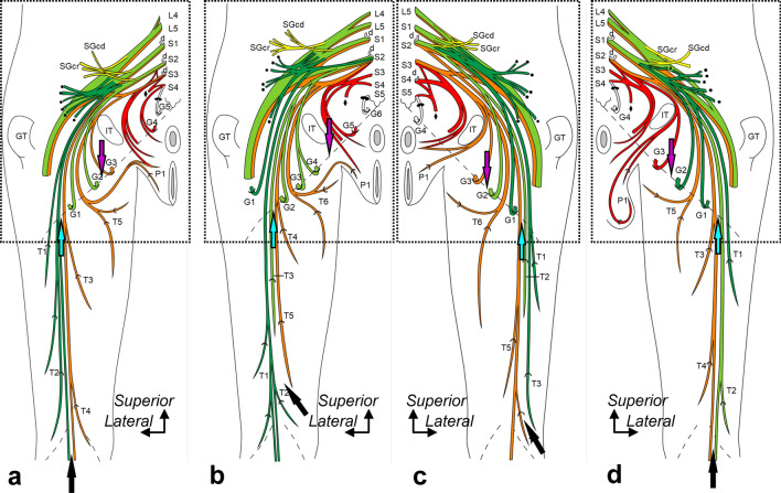 Origin, course, and distribution of the posterior femoral cutaneous nerve and the spatial relationship among its branches