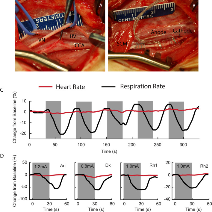 Vagus nerve stimulation in the non-human primate: implantation methodology, characterization of nerve anatomy, target engagement and experimental applications.