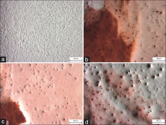 The effect of hyaluronic acid conditioned media on hDPSCs differentiation through CD44 and transforming growth factor-β1 expressions.