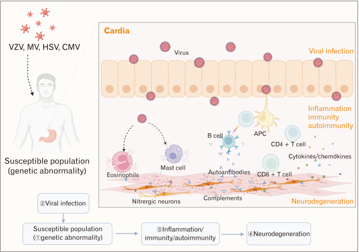 Achalasia: The Current Clinical Dilemma and Possible Pathogenesis.