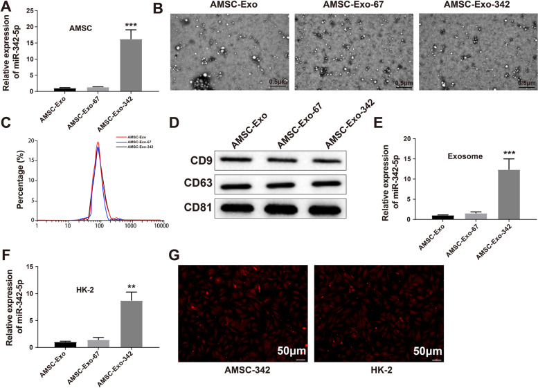 Exosomal microRNA-342-5p secreted from adipose-derived mesenchymal stem cells mitigates acute kidney injury in sepsis mice by inhibiting TLR9.