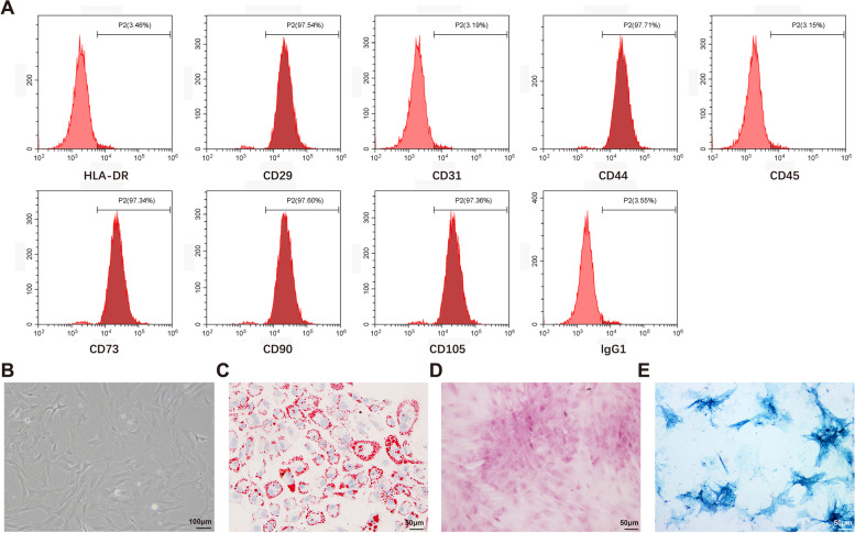 Exosomal microRNA-342-5p secreted from adipose-derived mesenchymal stem cells mitigates acute kidney injury in sepsis mice by inhibiting TLR9.