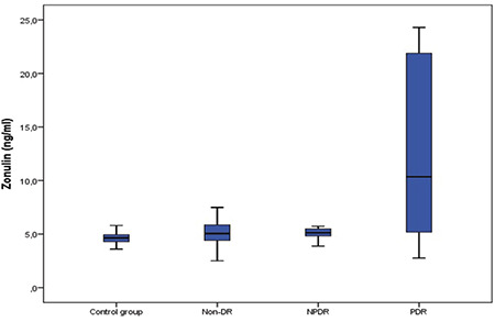 An Association Between the Intestinal Permeability Biomarker Zonulin and the Development of Diabetic Retinopathy in Type II Diabetes Mellitus.