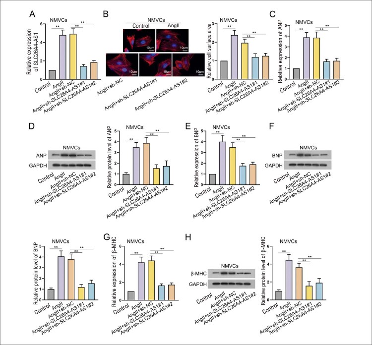 SLC26A4-AS1 Aggravates AngII-induced Cardiac Hypertrophy by Enhancing SLC26A4 Expression.