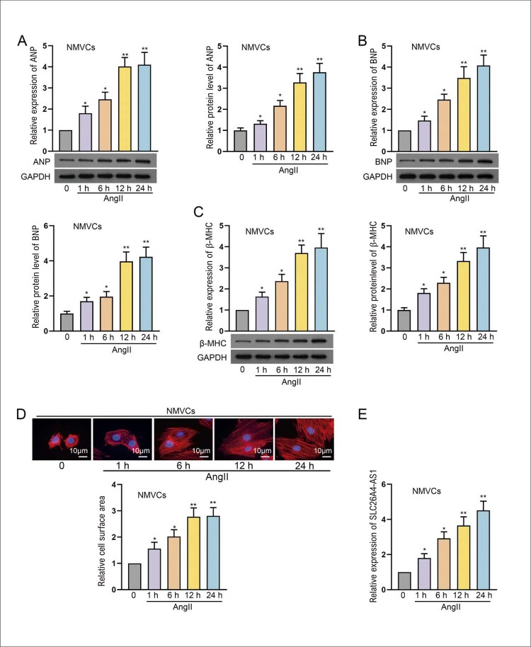 SLC26A4-AS1 Aggravates AngII-induced Cardiac Hypertrophy by Enhancing SLC26A4 Expression.