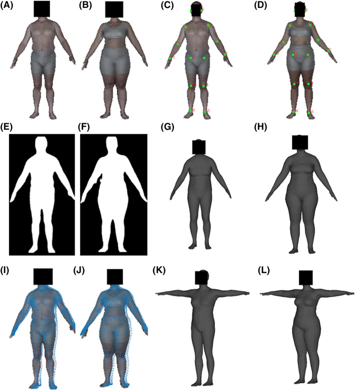 Modification and refinement of three-dimensional reconstruction to estimate body volume from a simulated single-camera image.