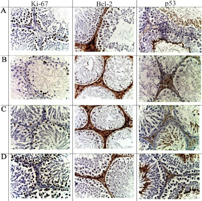 The Influence of Platelet-Derived Growth Factors on the Proliferation of Germinal Epithelium After Local Irradiation with Electrons.