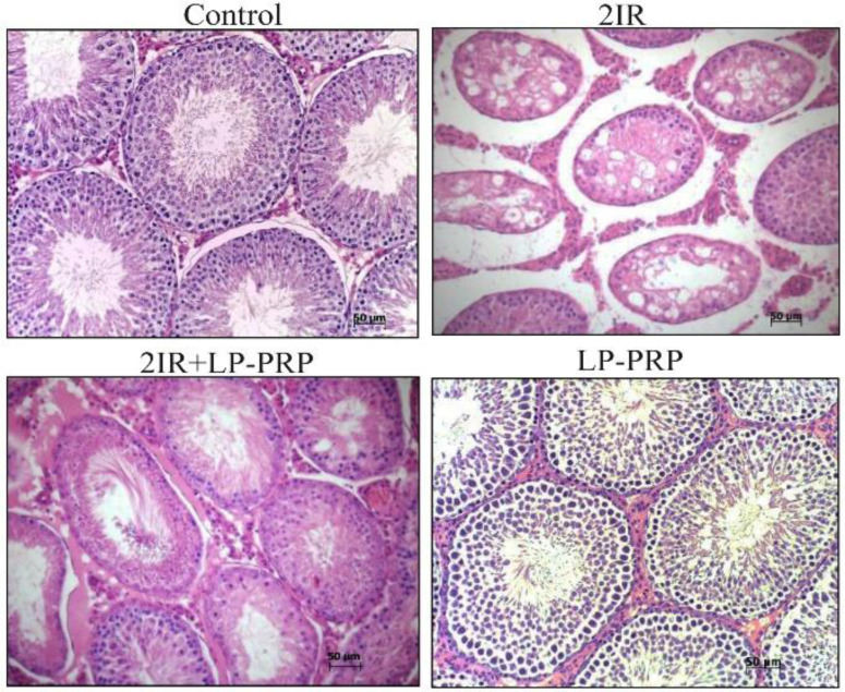 The Influence of Platelet-Derived Growth Factors on the Proliferation of Germinal Epithelium After Local Irradiation with Electrons.