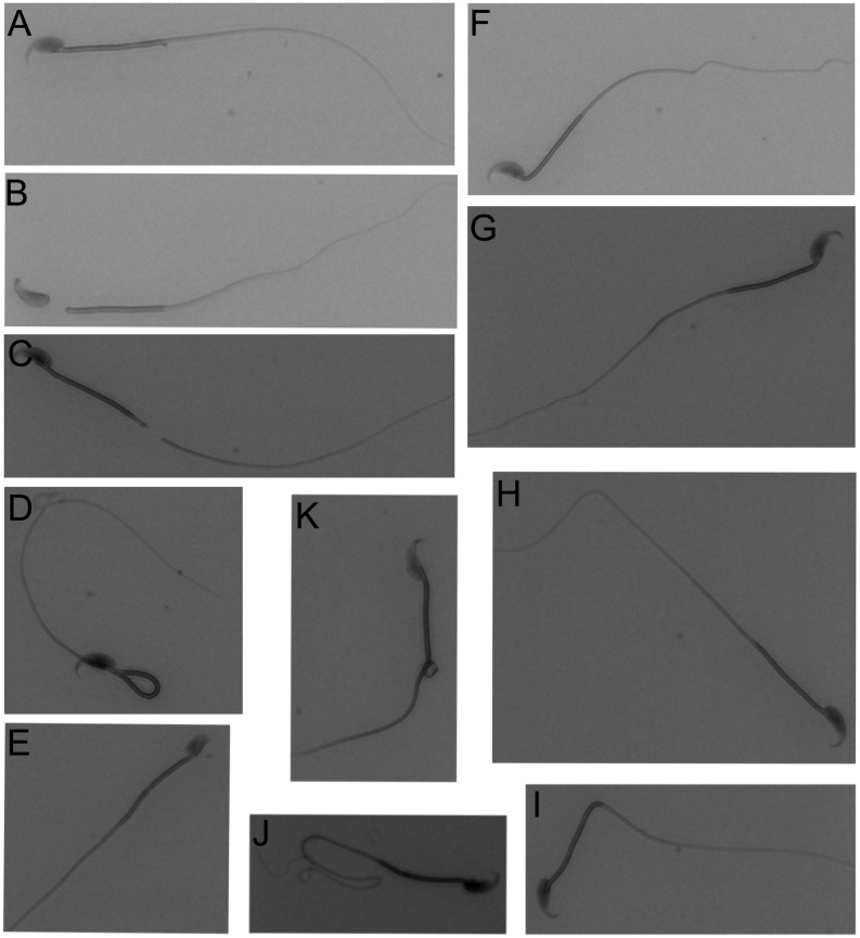 The impact of percutaneous epididymal sperm aspiration on sperm quality in mice.