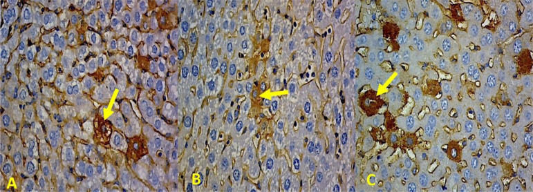 The acute effects of nonstructural-1 protein dengue virus type 2 on wet liver weight, zonulin expression and serum zonulin.