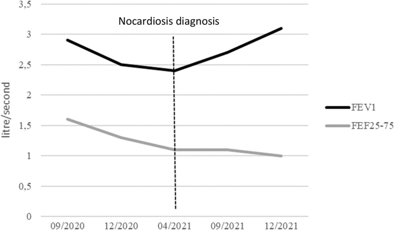 Several Nocardia abcessus bronchiolitis in a patient treated with inhaled corticosteroids: a case report.