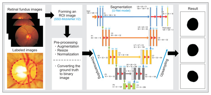 Automatic Method for Optic Disc Segmentation Using Deep Learning on Retinal Fundus Images.