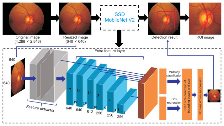 Automatic Method for Optic Disc Segmentation Using Deep Learning on Retinal Fundus Images.