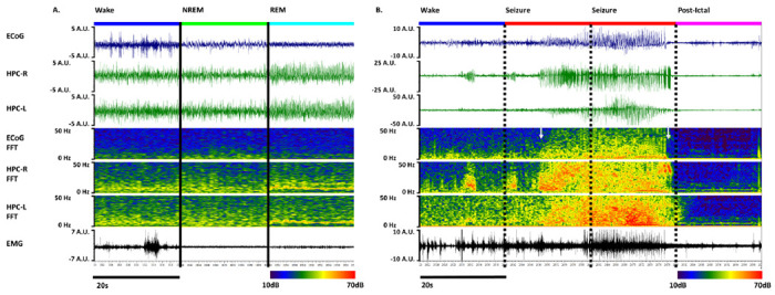 Automated Classification of Sleep-Wake States and Seizures in Mice.