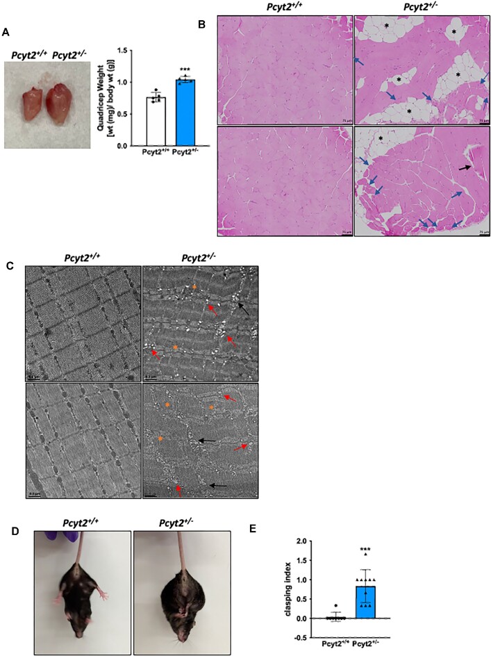 Skeletal Muscle Consequences of Phosphatidylethanolamine Synthesis Deficiency.