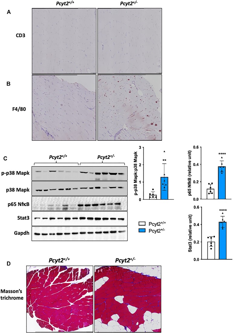 Skeletal Muscle Consequences of Phosphatidylethanolamine Synthesis Deficiency.