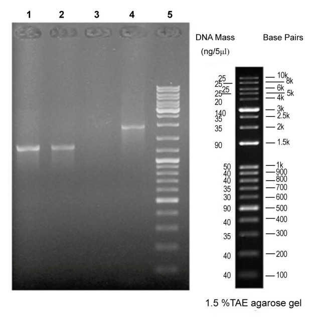 Response Surface Methodology to Optimize the Expression Efficiency of Recombinant Reteplase.