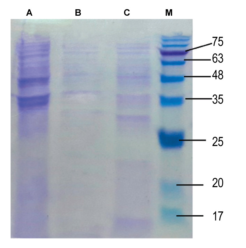 Response Surface Methodology to Optimize the Expression Efficiency of Recombinant Reteplase.