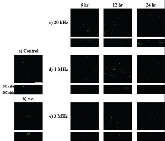 Effect of ultrasound treatment of the skin on activation of Langerhans cells and antibody production in rodents.