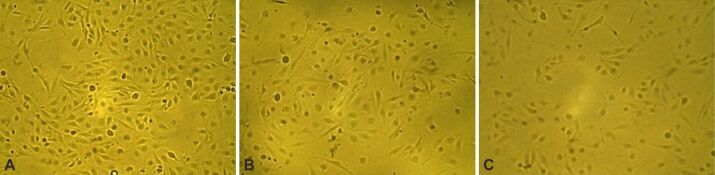 In vitro evaluation of Axitinib and Sorafenib treatment in glioblastoma cell viability and morphology.