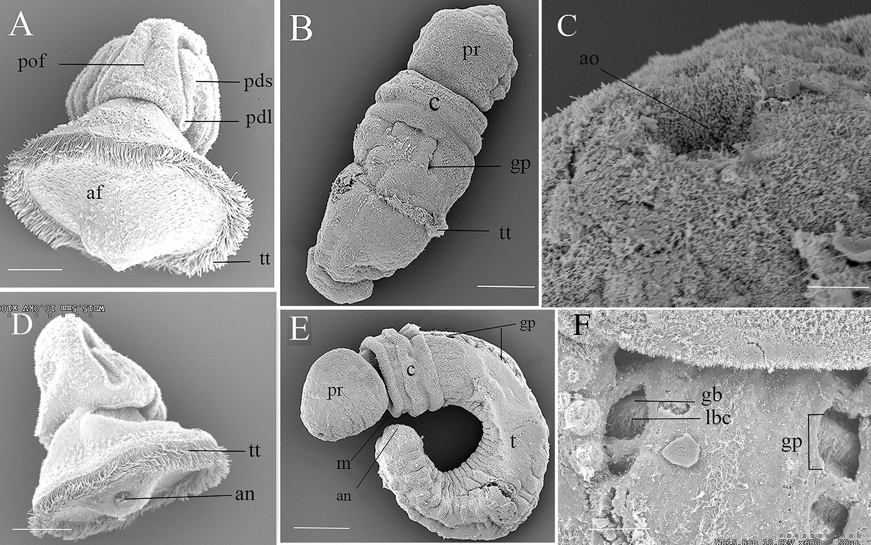 The embryology, metamorphosis, and muscle development of Schizocardium karankawa sp. nov. (Enteropneusta) from the Gulf of Mexico.