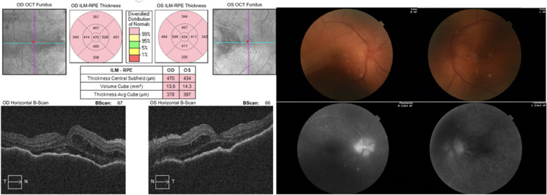 Ocular side effects of Trametinib and Dabrafenib: a case report.