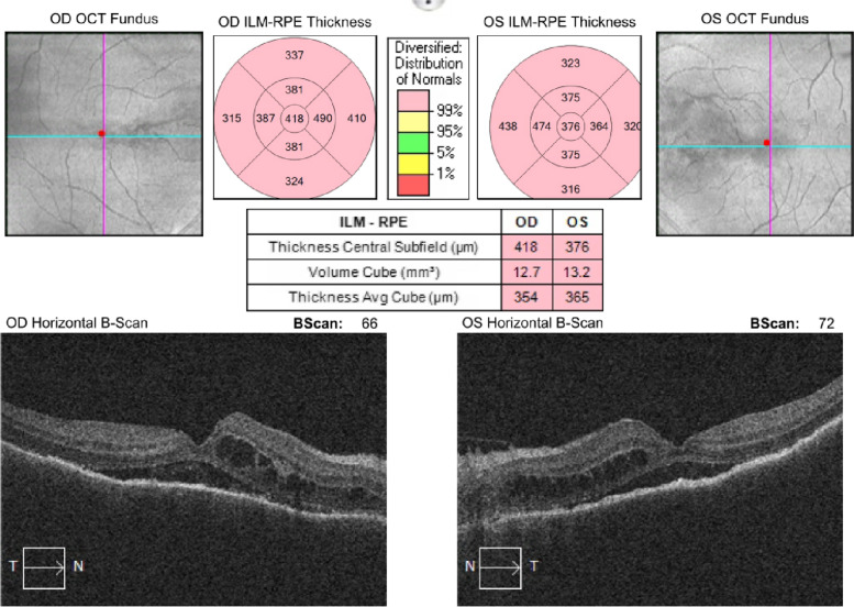 Ocular side effects of Trametinib and Dabrafenib: a case report.