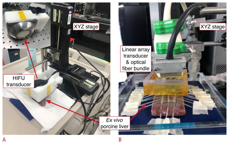 High-contrast spectroscopic photoacoustic characterization of thermal tissue ablation in the visible spectrum.