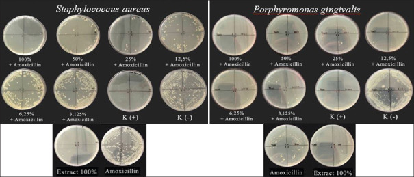 The Antibacterial and Antibiofilm Effect of Amoxicillin and <i>Mangifera indica</i> L. Leaves Extract on Oral Pathogens.