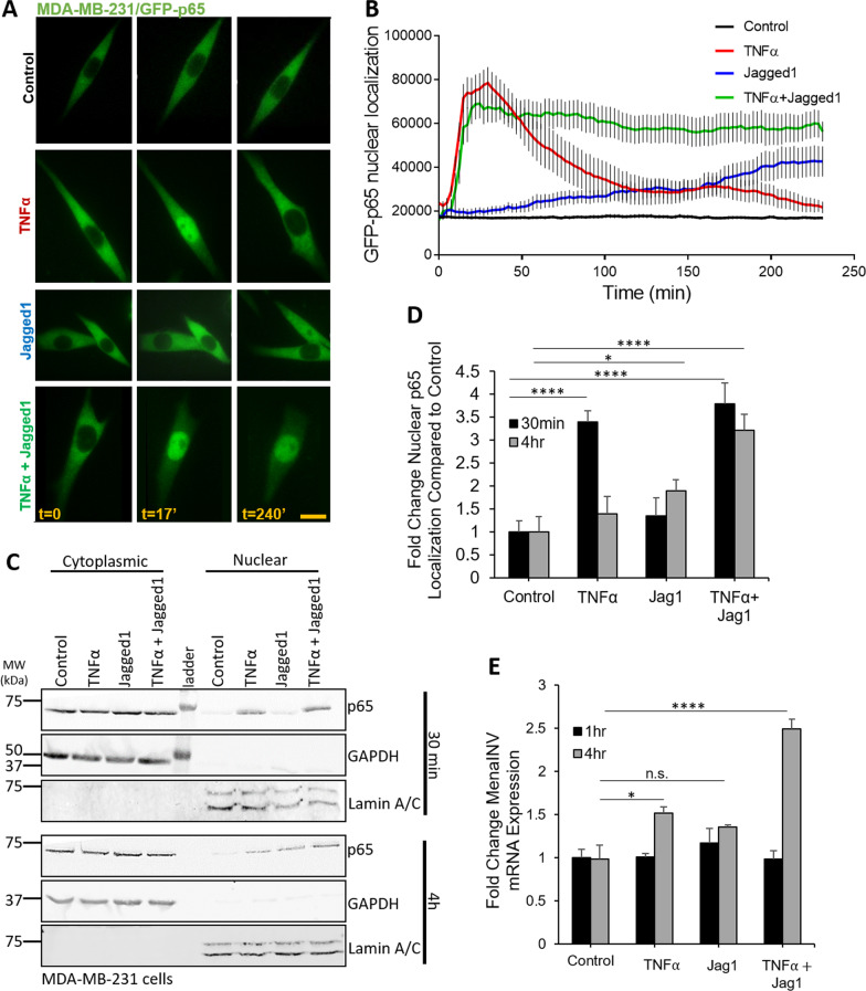 Cooperative NF-κB and Notch1 signaling promotes macrophage-mediated MenaINV expression in breast cancer.