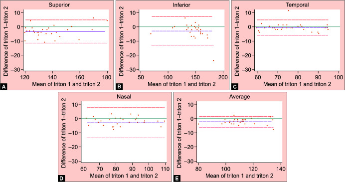 Agreement between Two Swept-source Optical Coherence Tomography: Optic Nerve Head, Retinal Nerve Fiber Layer and Ganglion Cell Layers in Healthy Eyes.