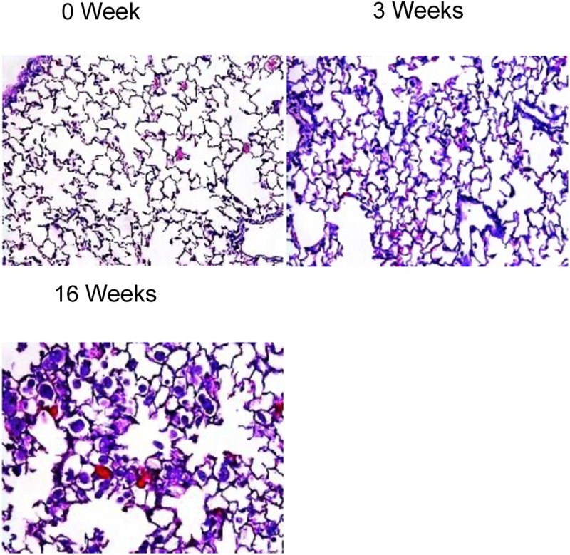 Gene Signatures for Latent Radiation-Induced Lung Injury Post X-ray Exposure in Mouse.