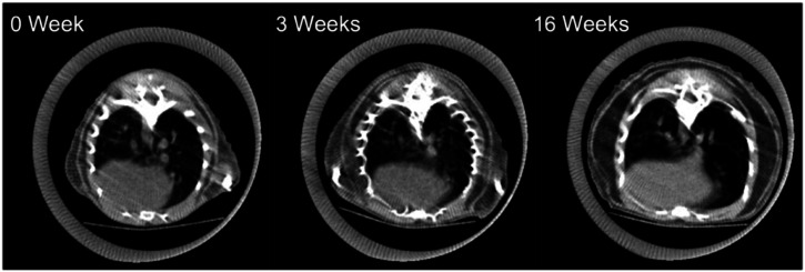 Gene Signatures for Latent Radiation-Induced Lung Injury Post X-ray Exposure in Mouse.