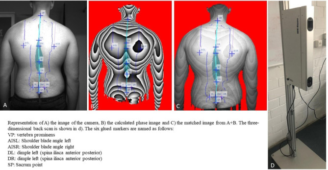 Musculoskeletal complaints, postural patterns and psychosocial workplace predictors in police officers from an organizational unit of a German federal state police force - a study protocol.