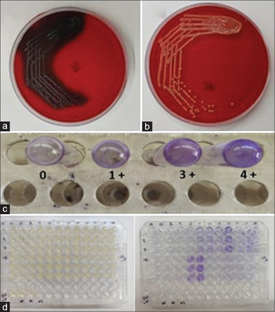 Central Line-Associated Bloodstream Infections: Effect of Patient and Pathogen Factors on Outcome.