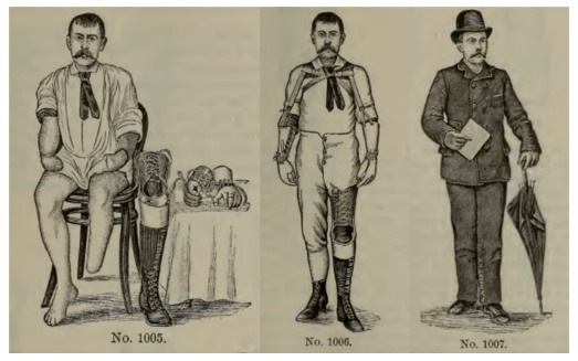 Prosthetics, Medicine, and Disability in Modern America: The Case of the A. A. Marks Artificial Limb Company.