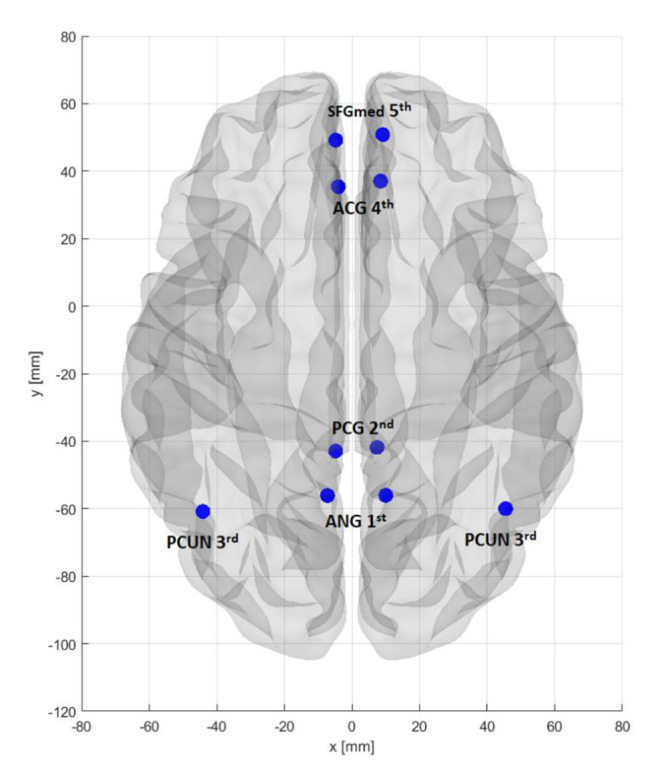 A Comparative Study of Correlation Methods in Functional Connectivity Analysis Using fMRI Data of Alzheimer's Patients.